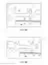 Fig. 09 - Fecal incontinence device, system and method