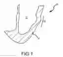 Fig. 02 - APPARATUS AND METHODS FOR SUPPORTING CARDIAC ISCHEMIC TISSUE BY MEANS OF EMBEDDED STRUCTURES