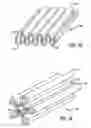Fig. 43 - ASSEMBLY AND METHOD FOR AUTOMATICALLY CONTROLLING PRESSURE FOR A GASTRIC BAND