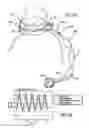 Fig. 49 - ASSEMBLY AND METHOD FOR AUTOMATICALLY CONTROLLING PRESSURE FOR A GASTRIC BAND