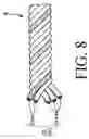 Fig. 09 - Tightening string for an endoscope, outer cover securing method, flexible tube for an endoscope, and an endoscope
