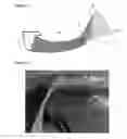 Fig. 08 - Laryngoscope
