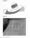 Fig. 22 - Laryngoscope