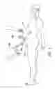 Fig. 02 - Balloon trocar