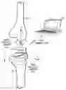 Fig. 01 - Sensored prosthetic component and method