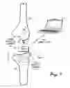Fig. 02 - Sensored prosthetic component and method