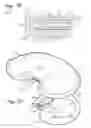 Fig. 22 - Sensored prosthetic component and method