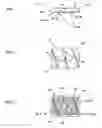 Fig. 02 - Biomedical electrode configuration for suppressing movement artifact