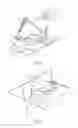 Fig. 06 - Navigation system for orthopaedic surgery
