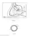 Fig. 07 - Method of confirming location of guide wire