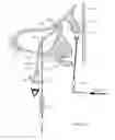 Fig. 34 - Method of confirming location of guide wire