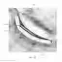 Fig. 41 - Method of confirming location of guide wire