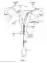 Fig. 02 - Methods for determining lumen occlusion