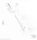 Fig. 03 - TREATMENT DEVICE