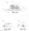 Fig. 12 - Systems and methods for non-invasively recording ECG in conscious ambulatory subjects