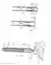 Fig. 04 - Automatic device for transcutaneous biopsy