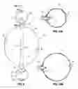 Fig. 07 - Intragastric implants with multiple fluid chambers