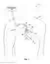 Fig. 02 - DIAGNOSIS OF LEAD FRACTURE AND CONNECTION PROBLEMS