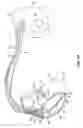 Fig. 03 - DIAGNOSIS OF LEAD FRACTURE AND CONNECTION PROBLEMS