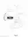 Fig. 07 - Spinal implant with padded bone engaging projections