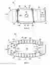 Fig. 08 - Spinal implant with attachable bone securing component