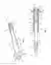 Fig. 02 - Implant system and method for stabilization of a sacro-iliac joint