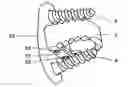 Fig. 01 - Vertebral cage device with modular fixation