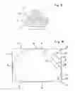 Fig. 03 - Cervical intervertebral prosthesis