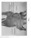 Fig. 03 - METHOD AND APPARATUS FOR DISTAL RADIOULNAR JOINT (DRUJ) ARTHROPLASTY