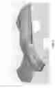 Fig. 18 - METHOD AND APPARATUS FOR DISTAL RADIOULNAR JOINT (DRUJ) ARTHROPLASTY