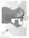 Fig. 25 - METHOD AND APPARATUS FOR DISTAL RADIOULNAR JOINT (DRUJ) ARTHROPLASTY