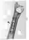 Fig. 28 - METHOD AND APPARATUS FOR DISTAL RADIOULNAR JOINT (DRUJ) ARTHROPLASTY