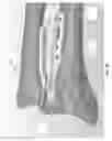 Fig. 31 - METHOD AND APPARATUS FOR DISTAL RADIOULNAR JOINT (DRUJ) ARTHROPLASTY