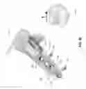 Fig. 37 - METHOD AND APPARATUS FOR DISTAL RADIOULNAR JOINT (DRUJ) ARTHROPLASTY