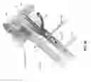 Fig. 40 - METHOD AND APPARATUS FOR DISTAL RADIOULNAR JOINT (DRUJ) ARTHROPLASTY