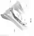 Fig. 41 - METHOD AND APPARATUS FOR DISTAL RADIOULNAR JOINT (DRUJ) ARTHROPLASTY