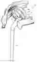 Fig. 01 - Shoulder joint repair