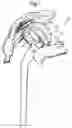 Fig. 02 - Shoulder joint repair