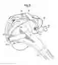 Fig. 06 - Shoulder joint repair