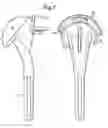 Fig. 07 - Shoulder joint repair