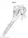 Fig. 09 - Shoulder joint repair