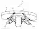 Fig. 01 - Arthroplasty systems and methods