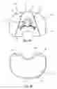 Fig. 04 - Arthroplasty systems and methods