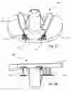 Fig. 06 - Arthroplasty systems and methods