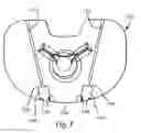 Fig. 08 - Arthroplasty systems and methods