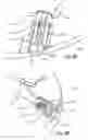 Fig. 09 - Arthroplasty systems and methods