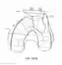 Fig. 167 - Patient-adapted and improved articular implants, designs and related guide tools