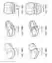 Fig. 197 - Patient-adapted and improved articular implants, designs and related guide tools