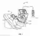 Fig. 02 - PATIENT-CONTROLLED VENTILATION