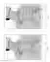 Fig. 09 - Obstructive sleep apnea treatment devices, systems and methods